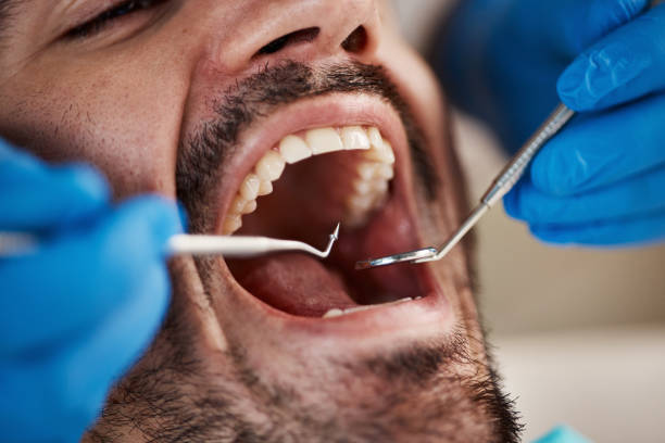 Best Emergency Dental Care for Abscessed Tooth in Ravenna, OH